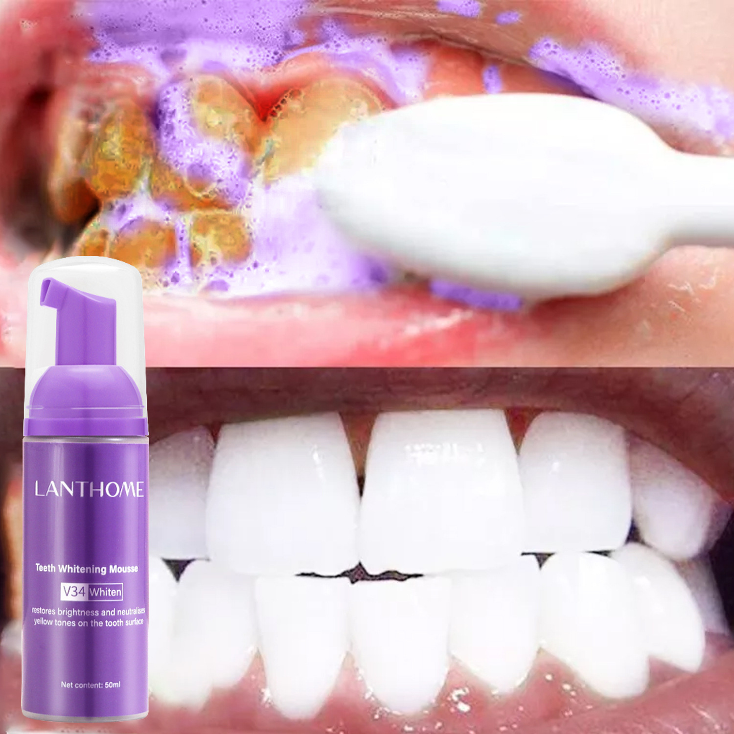 V34 Teeth Whitening Mousse Too - Teeth Whitening/Bleaching incelemesi ve fiyatı