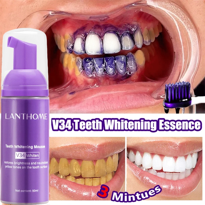 V34 Teeth Whitening Mousse Too - Teeth Whitening/Bleaching incelemesi ve fiyatı
