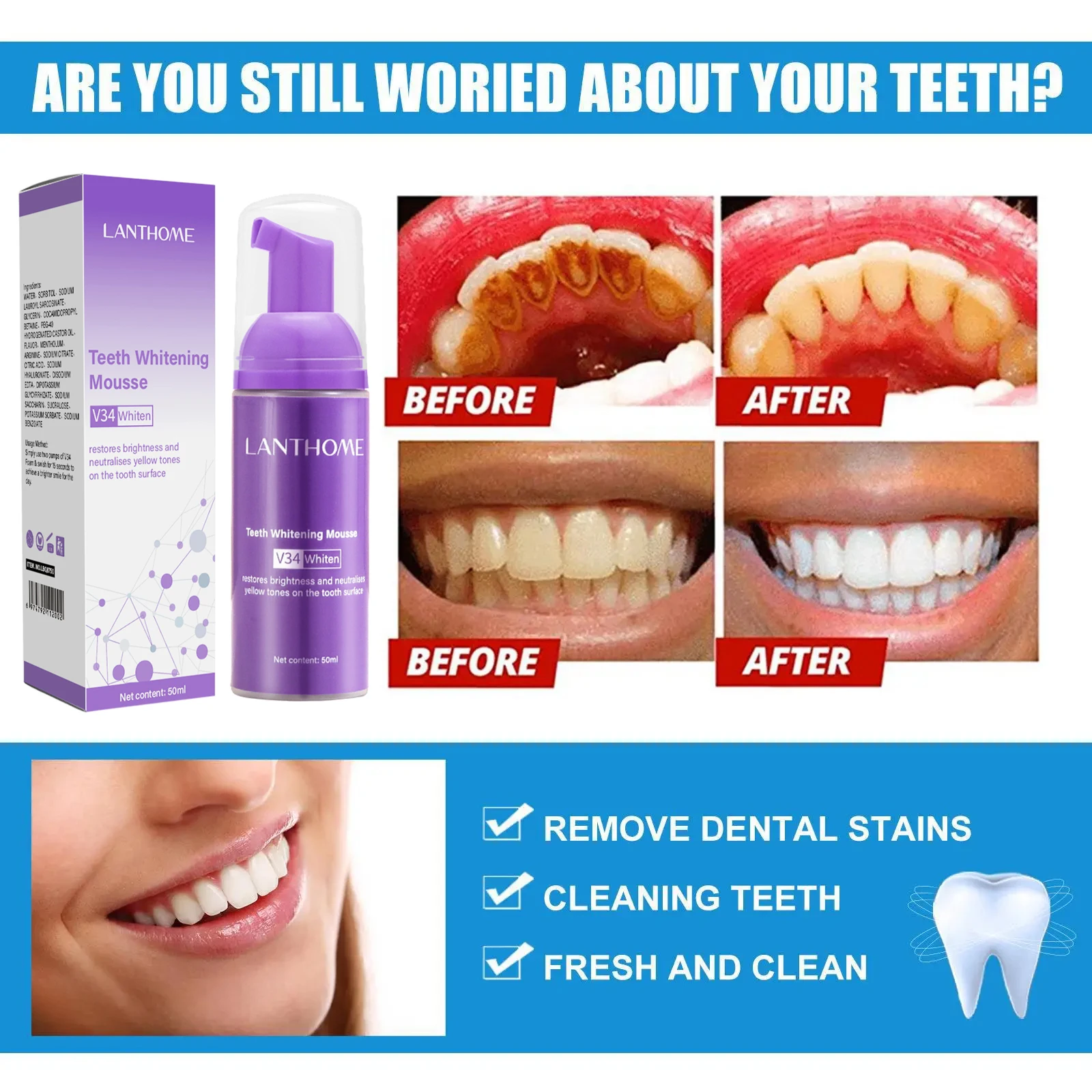 V34 Teeth Whitening Mousse Too - Teeth Whitening/Bleaching incelemesi ve fiyatı