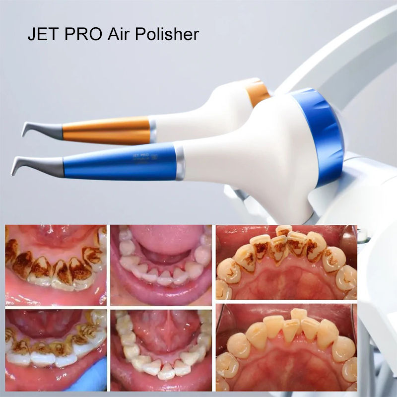 VV Dental  Air Polishing Proph - Teeth Whitening Dental incelemesi ve fiyatı