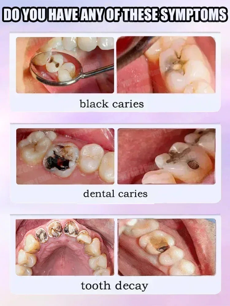 Hot sales Best-selling, Scient - Teeth Whitening Cream incelemesi ve fiyatı