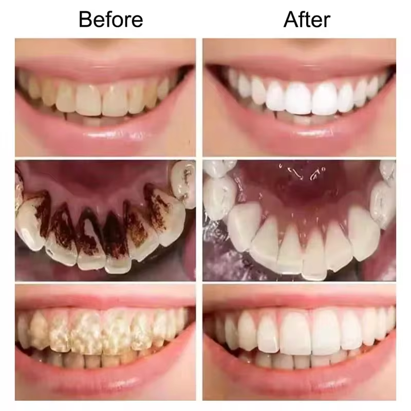 7.5% Hydroxyapatite Probiotic  - Teeth Whitening Cream incelemesi ve fiyatı