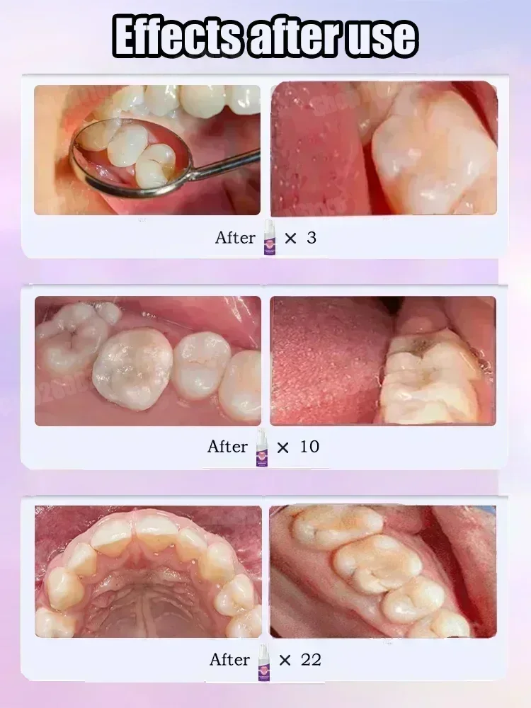 Teeth Cleaning Toothpaste Remo - Teeth Whitening Cream incelemesi ve fiyatı