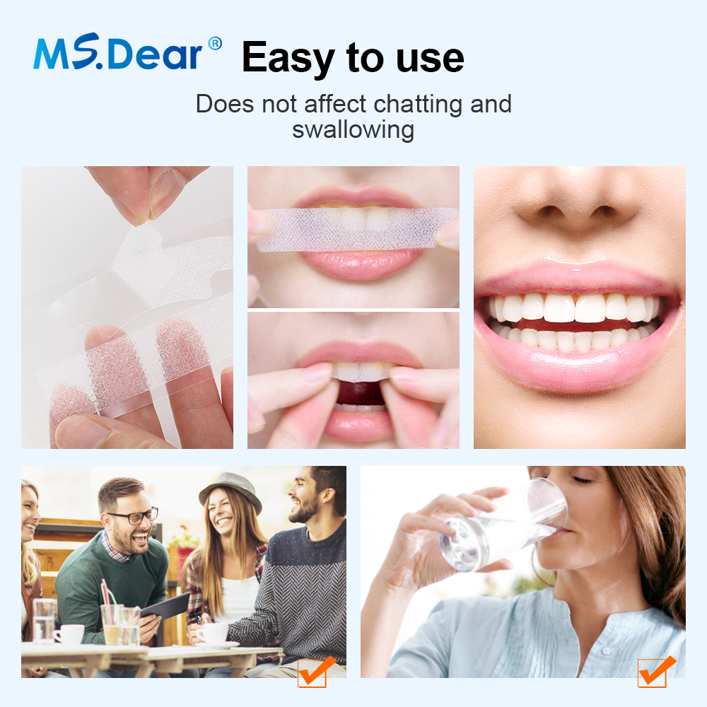 Teeth Whitening Strips Cleansi - Teeth Whitening/Bleaching incelemesi ve fiyatı